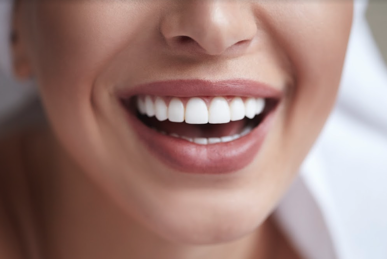 bright smile of patient | resin infiltration near me