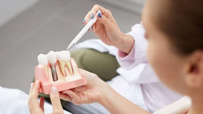 Dentist showing a patient a dental implant diagram in los gatos ca
