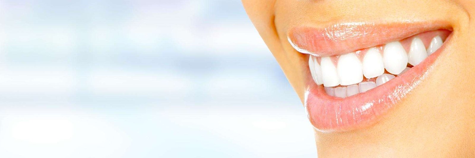 close up of woman's smile after cosmetic dentistry, los gatos ca